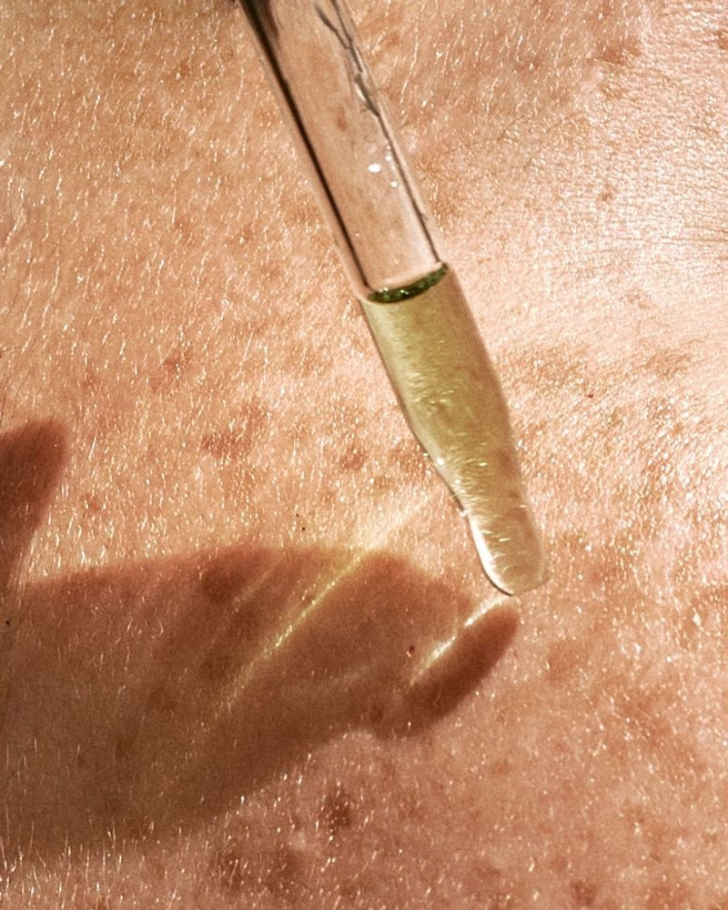 Пигментация