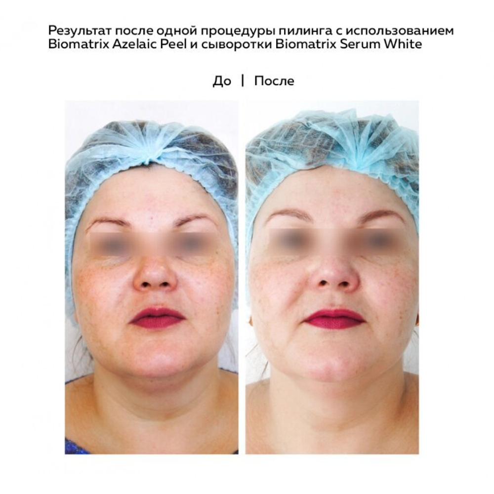 Biotime BIOMATRIX SERUM WHITE retinol 1% биотайм биоматрикс сыворотка для лица