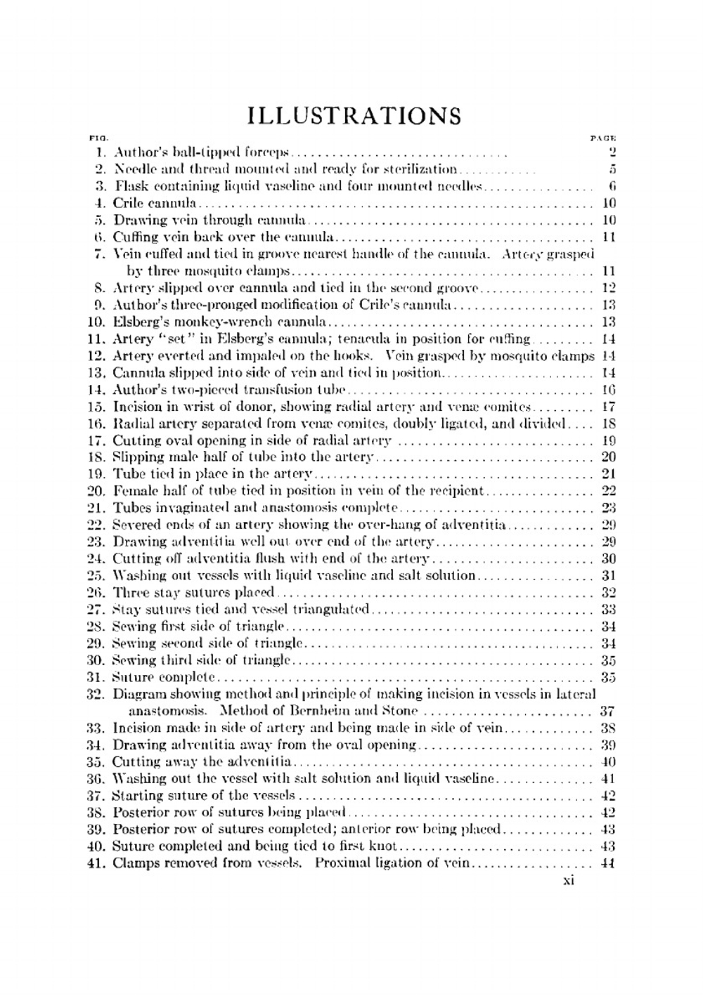 Surgery of the vascular system | Bertram Moses Bernheim