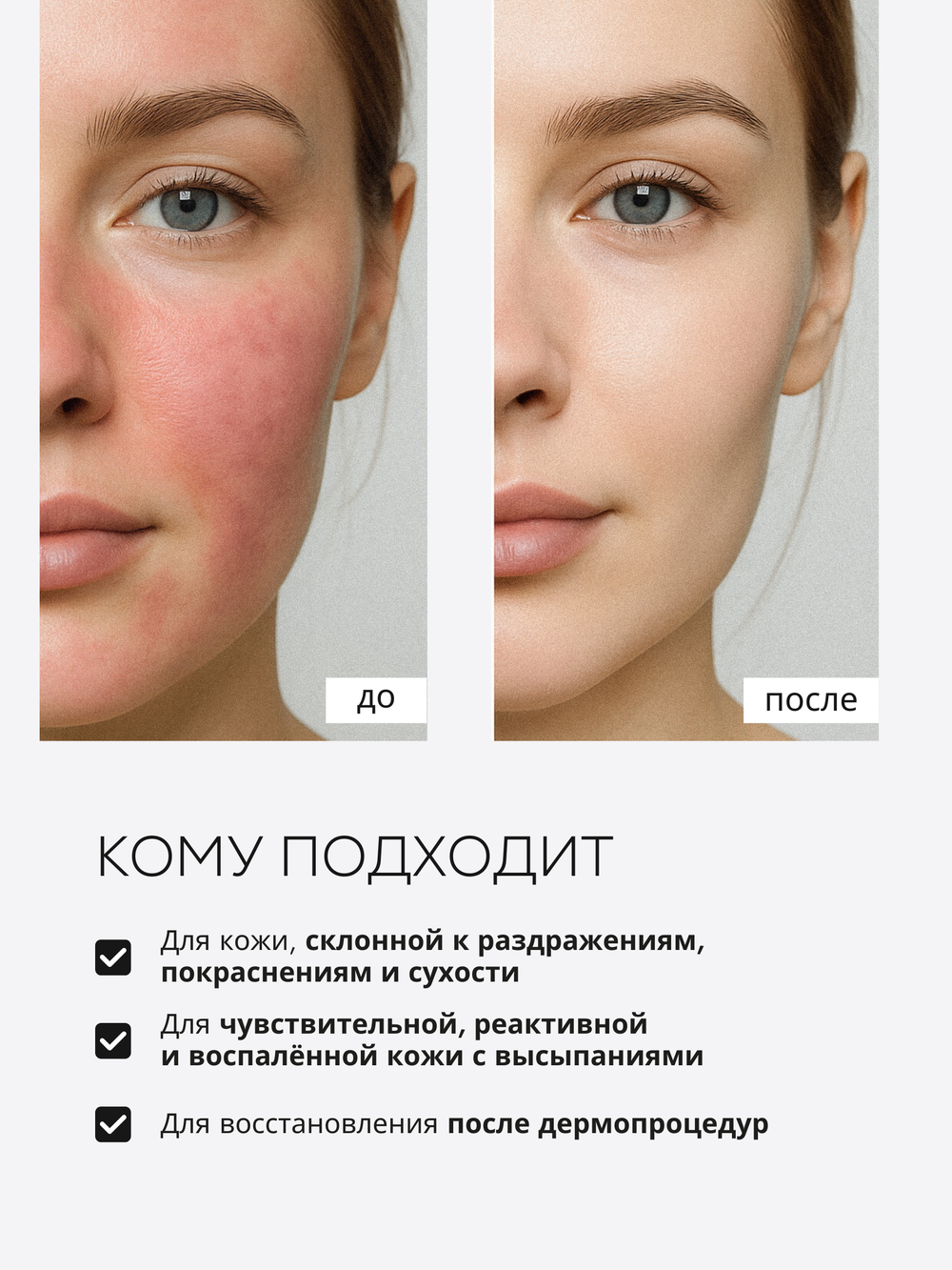 СЫВОРОТКА ДЛЯ ЧУВСТВИТЕЛЬНОЙ И РЕАКТИВНОЙ КОЖИ