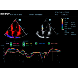 Аппарат УЗИ (сканер) Mindray DC-55