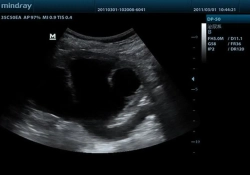 Аппарат УЗИ (сканер) Mindray DP-50