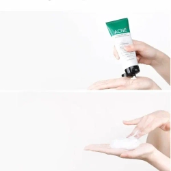 Some By Mi Пенка для проблемной кожи с кислотами - AHA-BHA-PHA 30Days miracle acne clear foam, 100мл