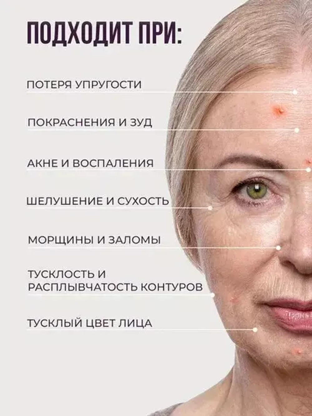 Восстанавливающий крем с нейропептидами Trimay NeuroPeptide LactoBiotic Ultra Repair Cream 50 мл