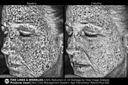 JAN MARINI AGE INTERVENTION RETINOL PLUS MD 1% Крем-акселератор с ретинолом 1% для борьбы с видимыми возрастными изменениями