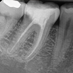 Радиовизиограф Handy HDR 380HD