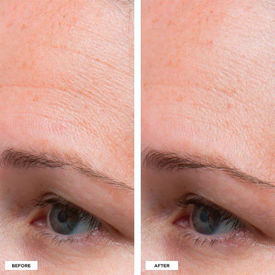 Увлажняющий крем Perricone MD High Potency Classics: Hyaluronic Intensive Moisturizer