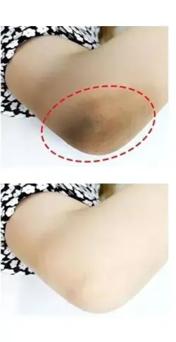 Веганский пилинг-тоник с 7% гликолевой кислоты The Ordinary Glycolic Acid 7% Exfoliating Toner 240 мл.