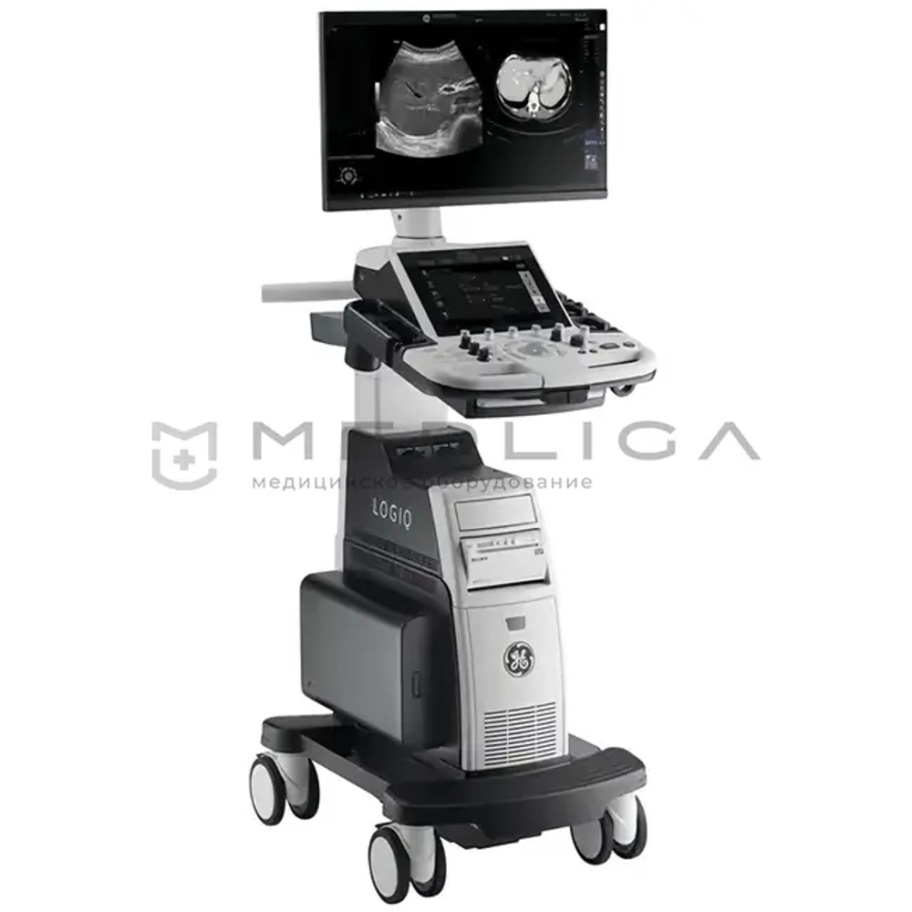 УЗИ аппарат GE LOGIQ P8