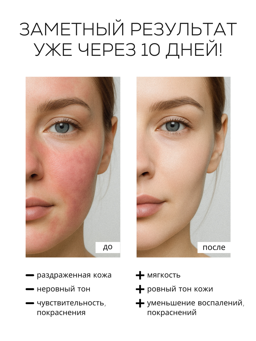 СЫВОРОТКА ДЛЯ ЧУВСТВИТЕЛЬНОЙ И РЕАКТИВНОЙ КОЖИ LAURA ZACKARYA — 2% ЭКТОИН И 2% СКВАЛАН