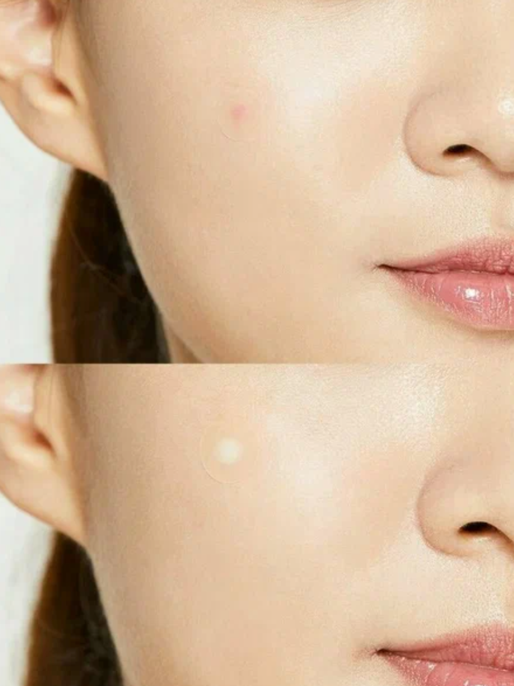 Патчи от прыщей Cosrx Acne Pimple Master Patch 24 шт.