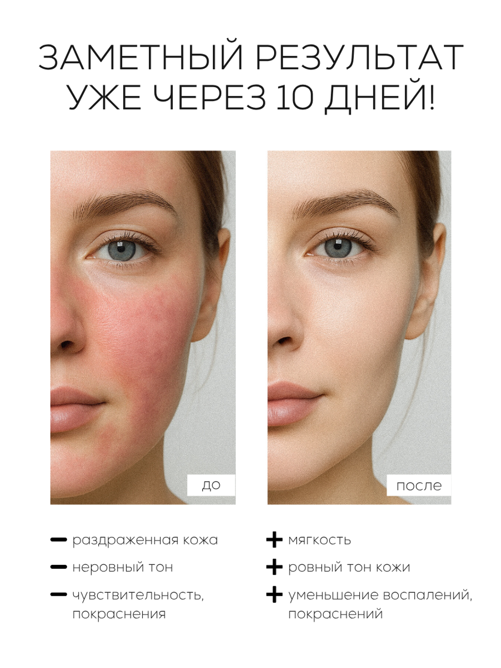 СЫВОРОТКА ДЛЯ ЧУВСТВИТЕЛЬНОЙ И РЕАКТИВНОЙ КОЖИ LAURA ZACKARYA — 2% ЭКТОИН И 2% СКВАЛАН