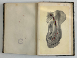 Пирогов Н. Атлас "Анатомия артериальных стволов и фиброзных фасций", 1837г. Дерпт, 54 л. цв. таб.