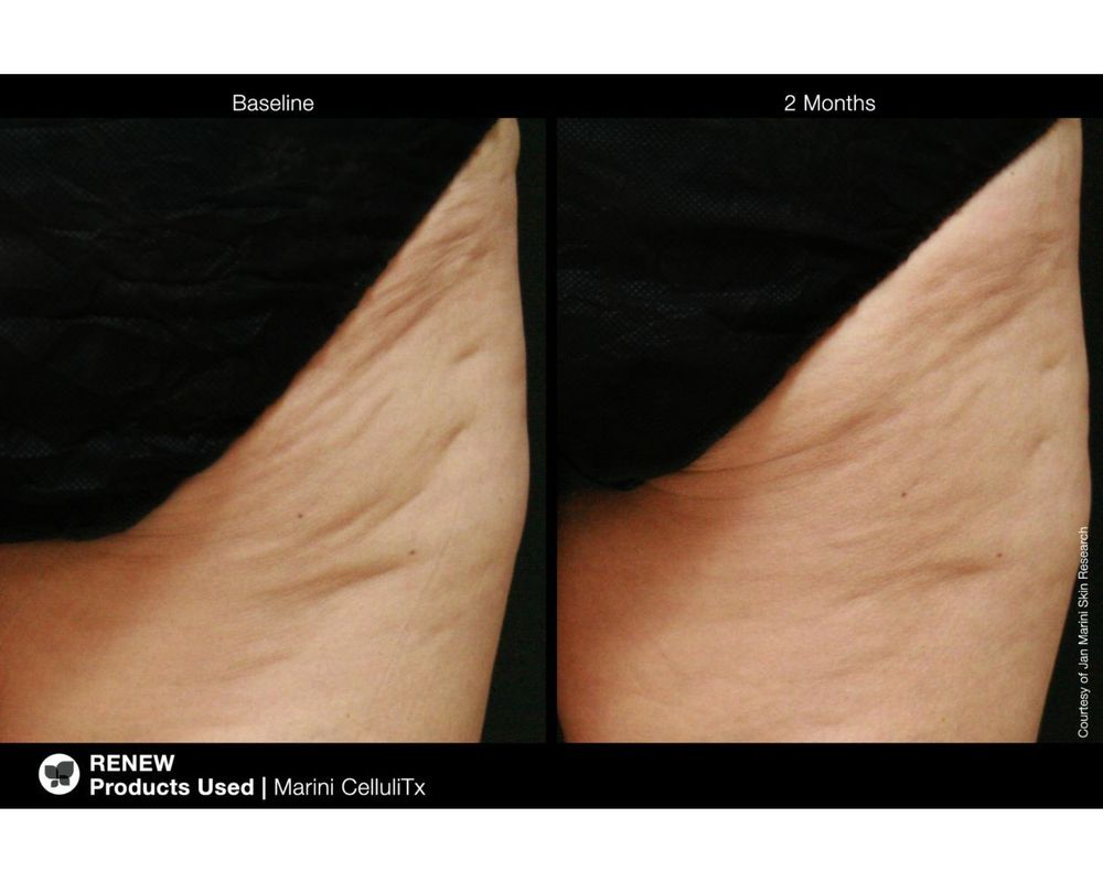 JAN MARINI CELLULITX Высокоэффективный антицеллюлитный крем