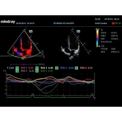 Аппарат УЗИ (сканер) Mindray DC-70