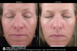 JAN MARINI SKIN CARE MANAGEMENT SYSTEM (NORMAL-COMBO) SPF33