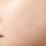 Патчи для проблемной кожи Elizavecca Witch Piggy Hell-Pore Blemish Spot Patch, 44 шт.