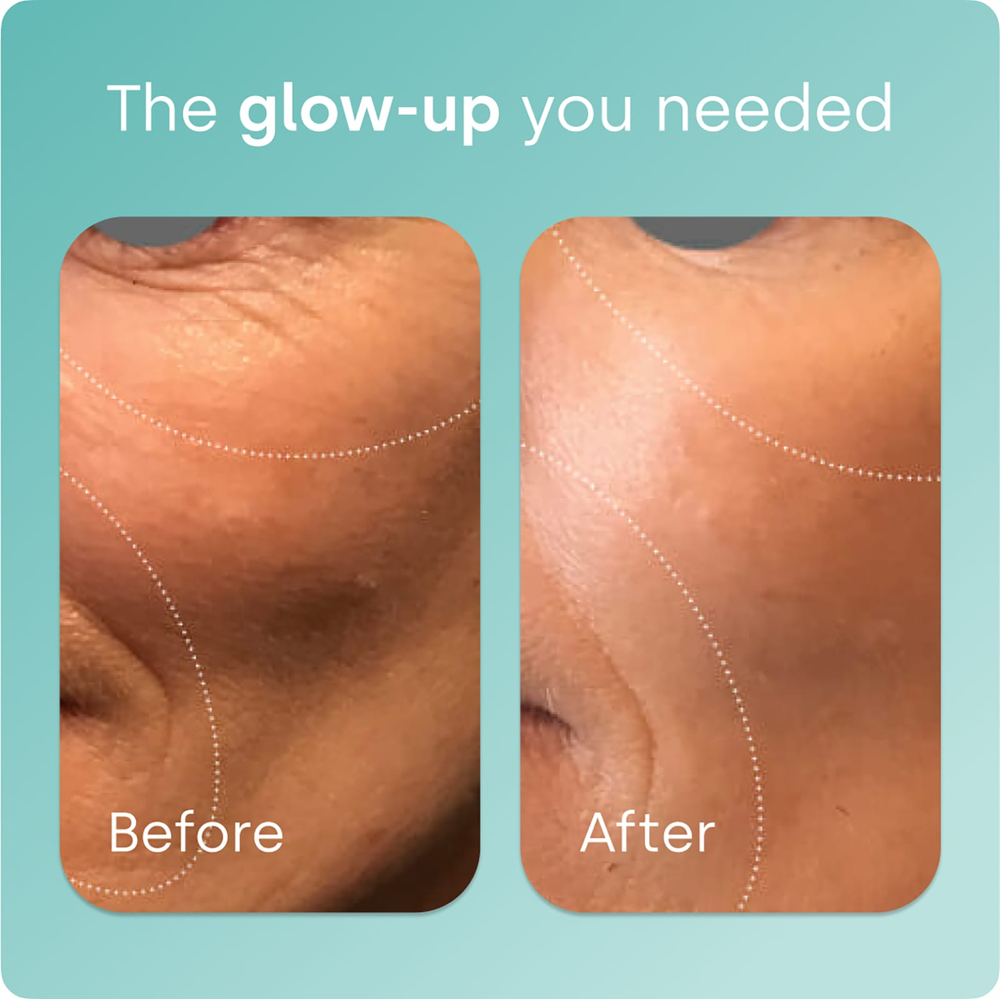 Biosil, Advanced Collagen Generator®, добавка для стимуляции выработки коллагена, 30 мл (1 жидк. унция)