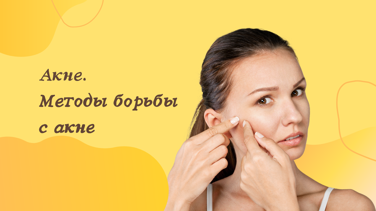 Акне. Что такое акне. Методы борьбы с акне