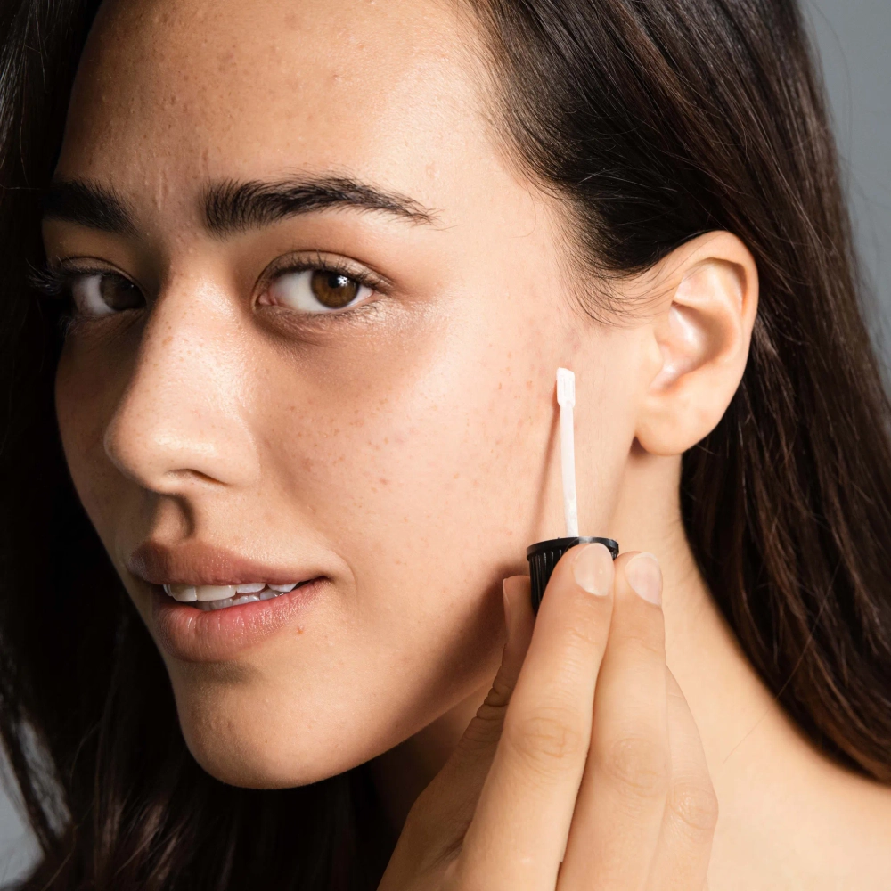 STOP ON SPOT [S.O.S] GEL - Гель-аппликатор SOS для проблемных зон, 10 мл