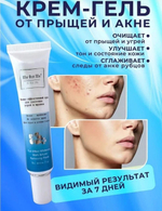 Мазь от акне