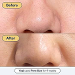 Remedy сыворотка For Pore Size для лица, 30мл