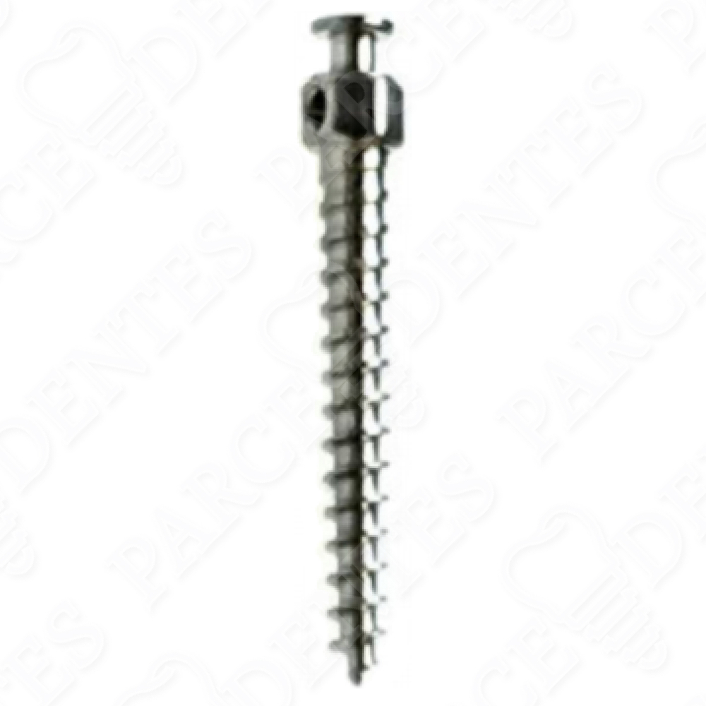 Ортовинты - микроимпланты для ортодонтии