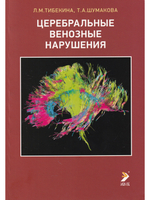 Церебральные венозные нарушения