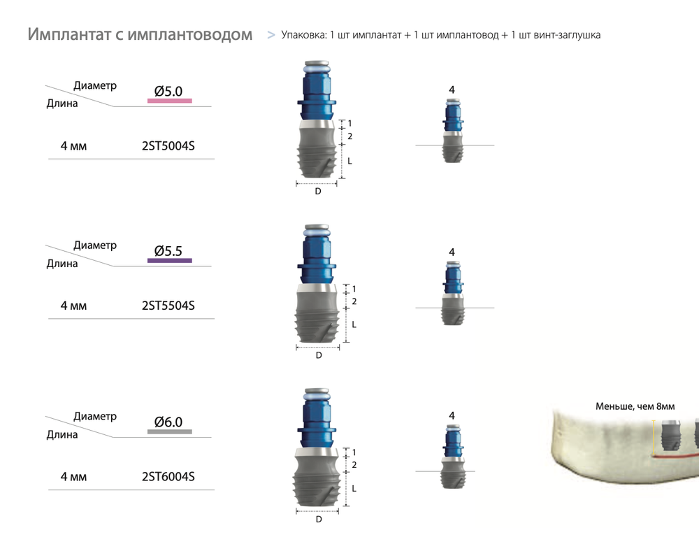 Импланты INNO