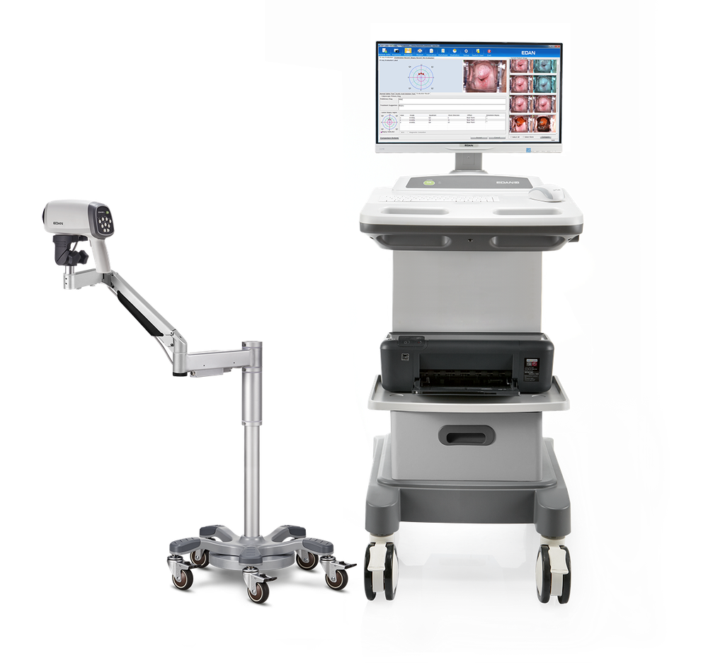 Видеокольпоскоп Edan C6 и Edan C6A