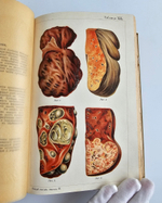 "Новый способ лечения. Лечение целебными силами природы."  М. Платен. 1906 г.