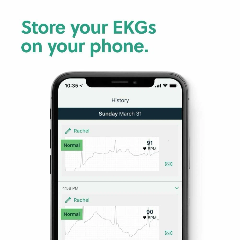Умный кардиодатчик AliveCor KardiaMobile — портативное устройство для фиксации электрических сигналов