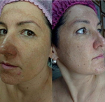 PDRN Glutathione Ampoule Eldermafill | Сияние и реструктуризация