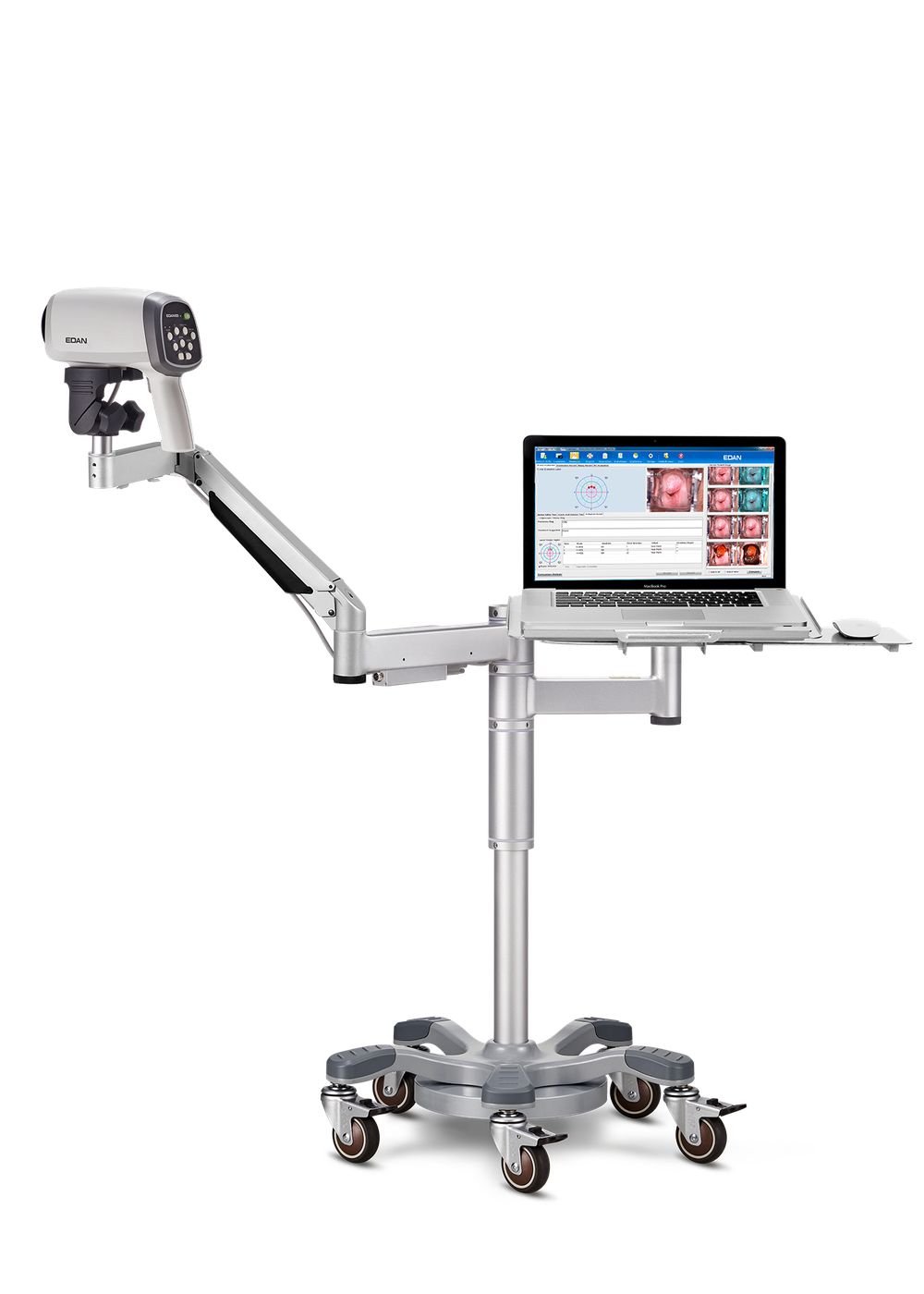 Видеокольпоскоп Edan C6 и Edan C6A