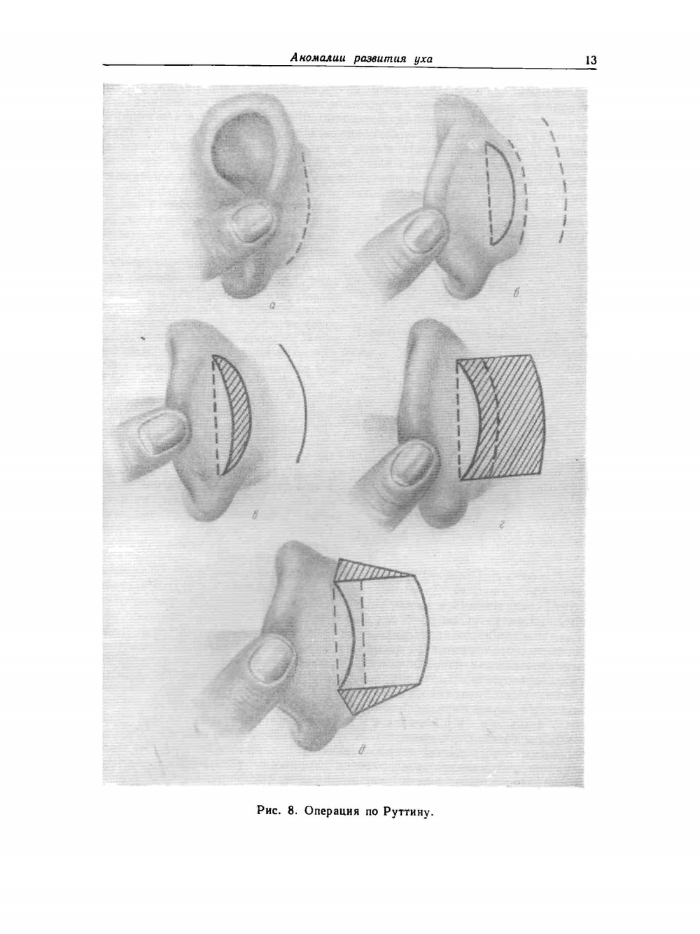 Руководство по оториноларингологии. Болезни уха | А.Г. Лихачев