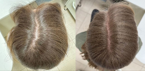 PERFOTESORO кислородная сыворотка для активного роста волос