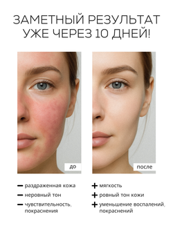 СЫВОРОТКА ДЛЯ ЧУВСТВИТЕЛЬНОЙ И РЕАКТИВНОЙ КОЖИ