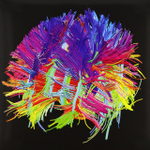 Muse / The 2nd Law (Limited Edition)(2LP+CD+DVD)
