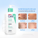 CeraVe Гель для умывания Foaming cleanser for nolmal to oily skin 236ml