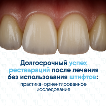Долгосрочный успех и выживаемость реставраций после эндодонтического лечения без использования штифтов: практика-ориентированное исследование