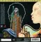 Miles Davis – Bitches Brew - MFSL - 2SACD