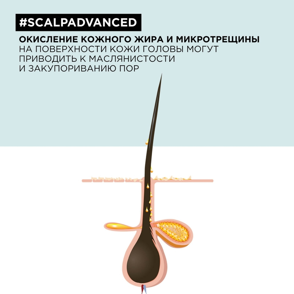 L'Oreal Скальп Анти-Ойл шампунь 500мл