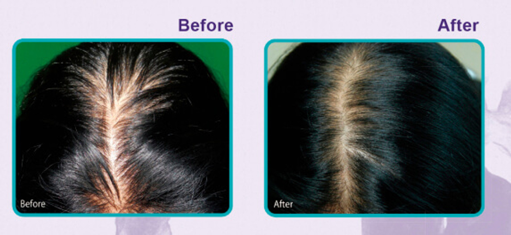 Daeng Gi Meo Ri Vitalizing Scalp Pack for Hair-loss средство против выпадения волос