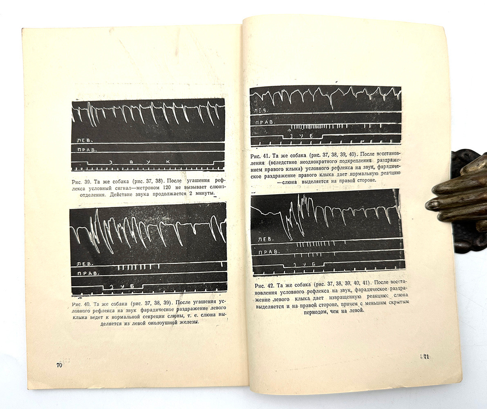 Гедеванишвили Д. М. (АВТОГРАФ) .О парной и раздельной работе больших полушарий головного мозга.1956г