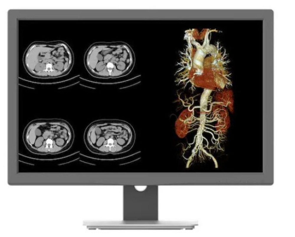 Монитор 24" Jusha JUSHA-CR240G