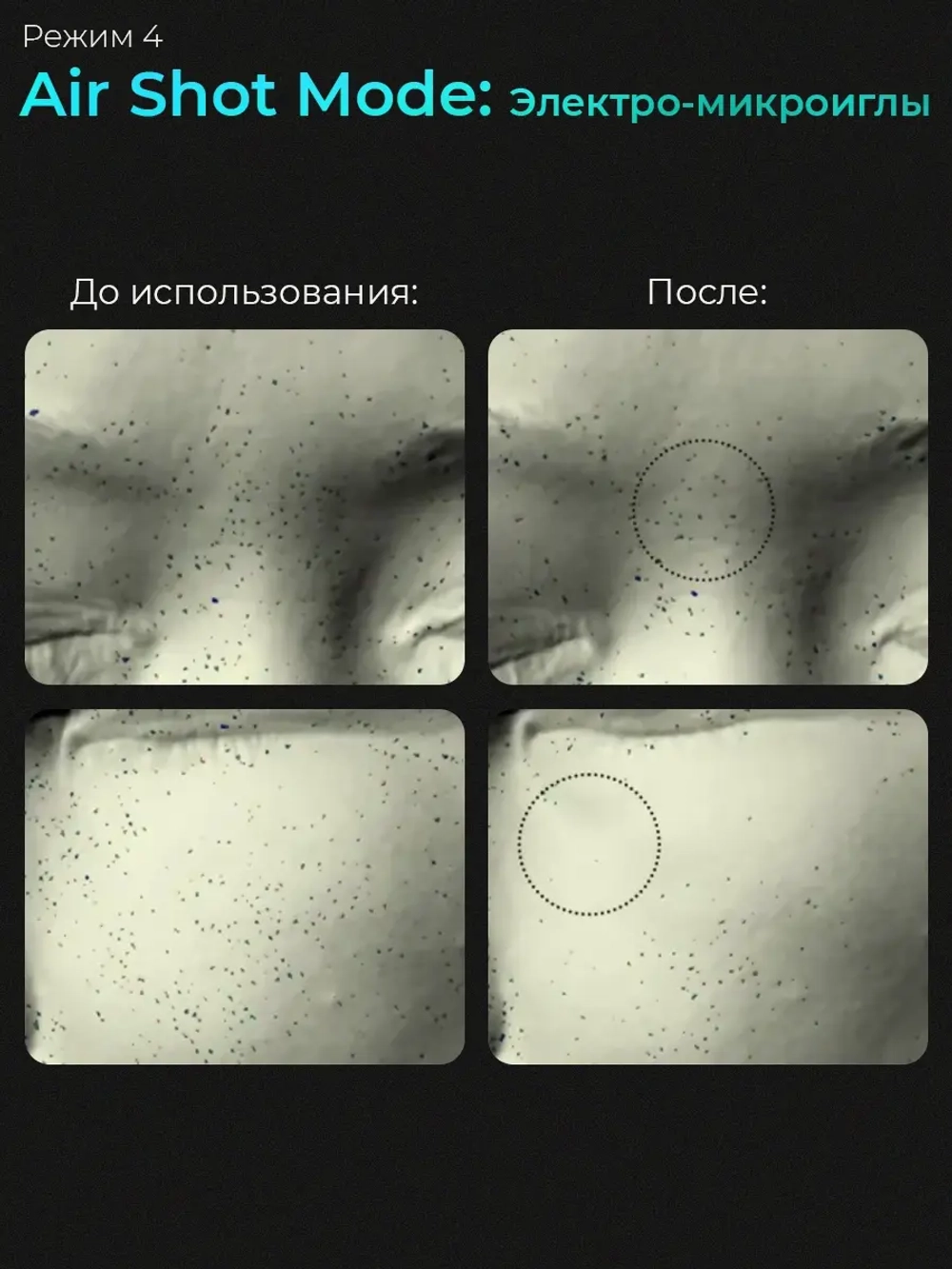 Medicube Микротоковый аппарат для лица 6-в-1 AGE-R Booster Pro Pink