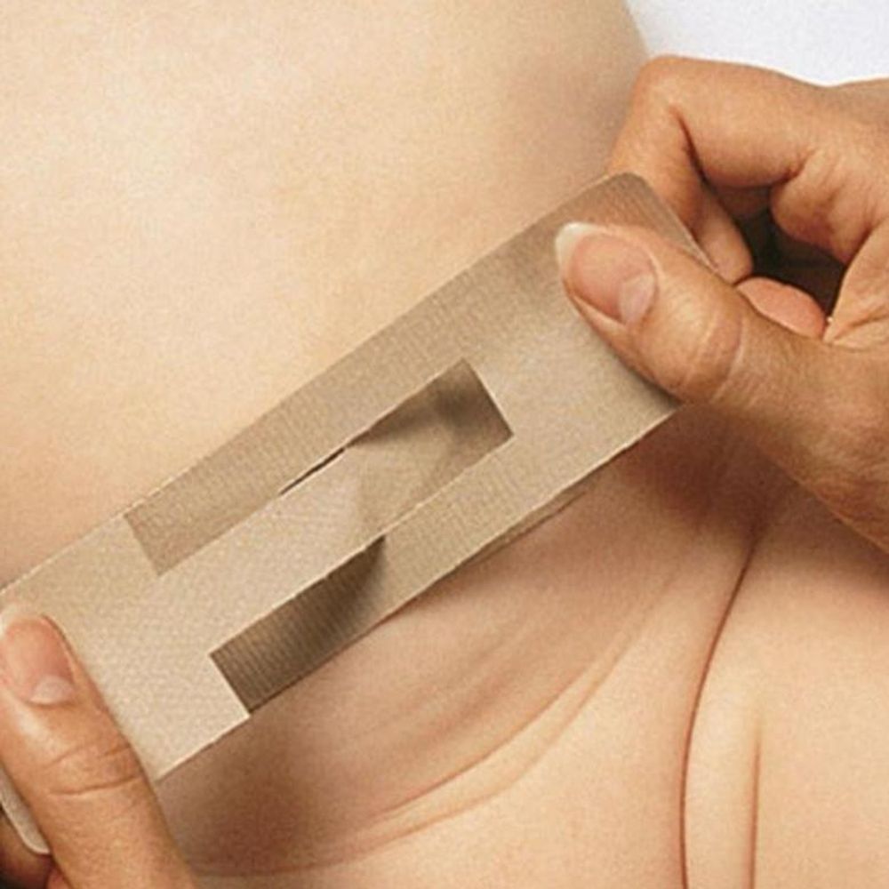 Poroifix пластырь для пупочной грыжи у младенцев