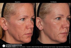 JAN MARINI AGE INTERVENTION RETINOL+ 0,5% Крем-акселератор с ретинолом 0,5% для борьбы с видимыми возрастными изменениями