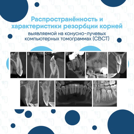 Распространённость и характеристики резорбции корней, выявляемой на конусно-лучевых компьютерных томограммах (CBCT)