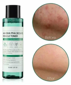 Some By Mi Тонер с 3 видами кислот и ниацинамидом - AHA-BHA-PHA 30days miracle toner, 150мл